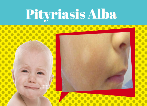 Pityriasis Alba National Pharmacy